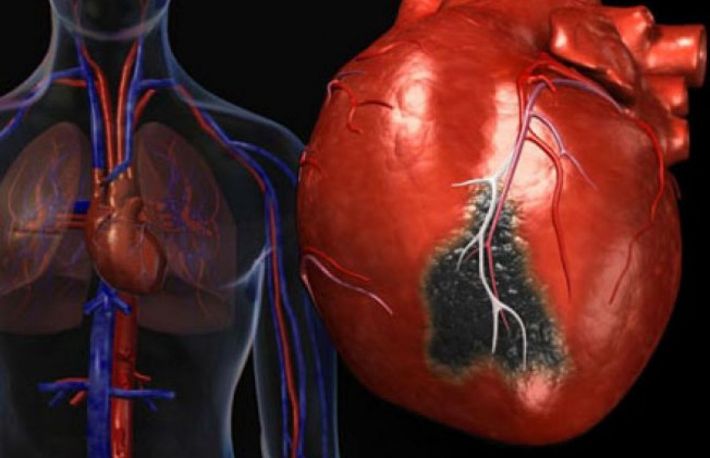Cum sa obtii o diploma de absolvire a unui curs de resuscitare cardiopulmonara